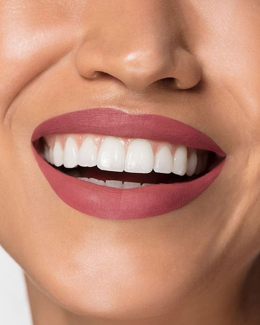 Los Beneficios del Blanqueamiento Dental - Transformando Tu Sonrisa